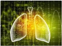 尼达尼布治疗特发性肺纤维化效果明显吗