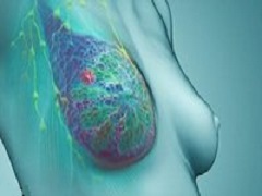 T-DM1联用来那替尼可增加乳腺癌缓解率