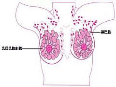 帕博西尼对乳腺癌患者的帮助大吗？