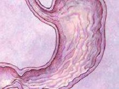 雷莫芦单抗加入紫杉醇可维持晚期胃癌的生活质量