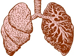 尼达尼布能够控制肺纤维化进程