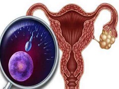 帕唑帕尼治疗晚期卵巢癌的效果怎么样？