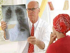 肺癌患者要不要选择色瑞替尼