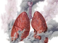 非小细胞肺癌患者是否可以服用曲美替尼联合治疗