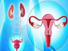 尼拉帕尼对复发性卵巢癌患者生活质量的影响