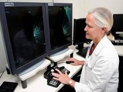 帕博西尼能够安全有效地治疗乳腺癌