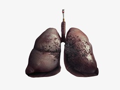国内肺癌晚期患者使用色瑞替尼疗效怎么样？