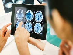 如何预防脑肿瘤？