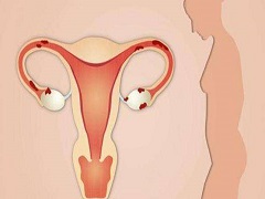 卵巢癌患者可以使用马法兰进行治疗