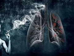 肺癌一线治疗使用色瑞替尼效果好吗？