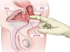 如何处理阿比特龙的副作用肝毒性呢？