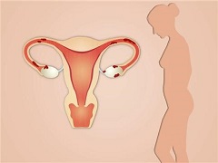 与卵巢癌混淆的疾病有哪些？
