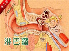 治疗淋巴癌的方法有哪些？淋巴癌能活多久呢？