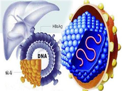 慢性乙肝的发病原因你知道多少呢