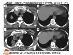 靶向药物克唑替尼的主治功能是什么？