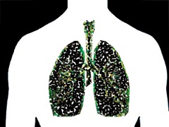 尼达尼布和肺癌靶向治疗的未来