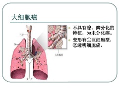 和免疫疗法相比为什么艾乐替尼效果更好