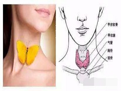 甲状腺癌的诱因