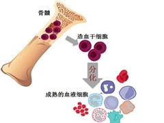 如何预防白血病？