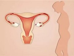 奥拉帕尼和西地尼布联合治疗卵巢癌效果如何？