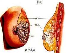 帕博西尼效果如何