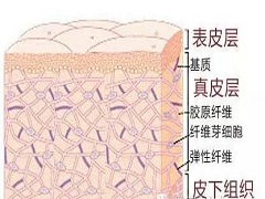 治疗银屑病苏金单抗不会产生耐药性 