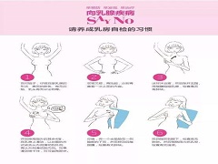 帕博西尼对乳腺癌的治疗