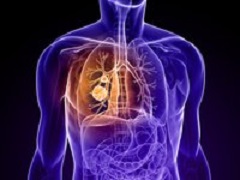 新一代ALK-TKI布加替尼治疗肺癌的效果与克唑替尼相比哪个好？
