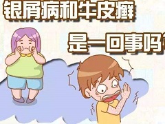 阿普斯特是治疗银屑病关节炎的首个口服药物