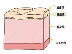 苏金单抗能治疗哪些类型银屑病