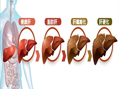 索拉非尼治疗适应症的有效率是多少
