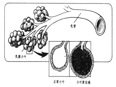 帕博西尼效果怎么样