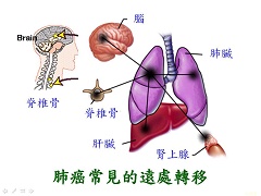 艾乐替尼价格是多少