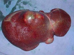 哪些特定肺癌患者对索拉非尼反应良好？