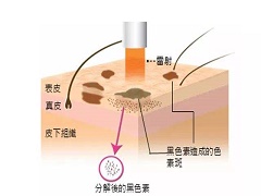 威罗菲尼联合治疗可降低抗性