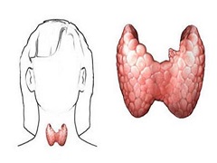 甲状腺癌能不能选择凡德他尼