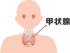凡德他尼对于甲状腺癌的治疗效果 