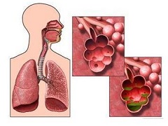 尼达尼布与西地那非治疗特发性肺纤维化患者