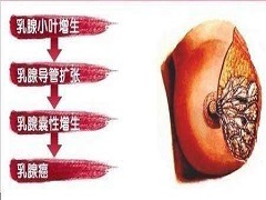 亚洲女性使用帕博西尼效果好不好
