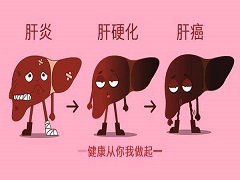 索拉非尼可延长晚期肝癌患者生存期