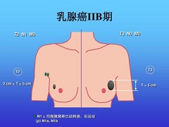 来那替尼的有效性已被证实