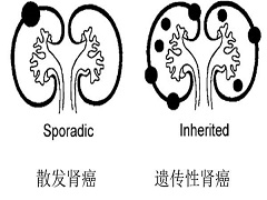 阿西替尼能和派姆单抗联用吗？