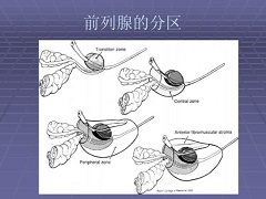 使用恩杂鲁胺联合阿比特龙可治疗前列腺癌吗