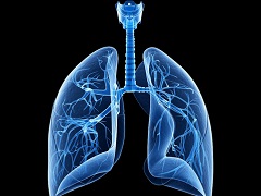 接受尼达尼布治疗的患者可能出现其他肺部疾病进程