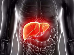 慢性肝病患者使用奥贝胆酸可能会造成肝损伤
