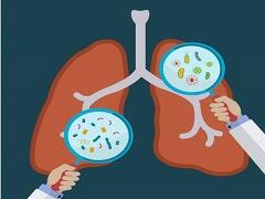 将克唑替尼用于肺癌的辅助治疗效果如何？