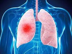 哪些罕见的基因突变肺癌可以使用阿法替尼？