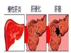 瑞戈非尼联合治疗结直肠癌的新型潜在策略