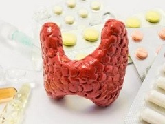 甲状腺癌的五种分类