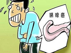 胰腺癌难以发现
